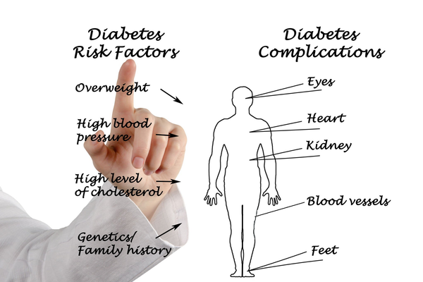 Diabetes Risk Factors: Symptoms, Causes, Risks (2023)