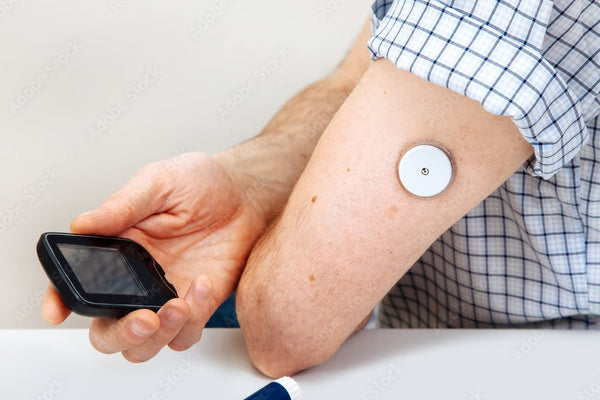sensor diabetes chequeo glucosa hombre sistema azúcar monitoreo escanear prueba mano piel medicina jeringuilla mesa fondo blanco