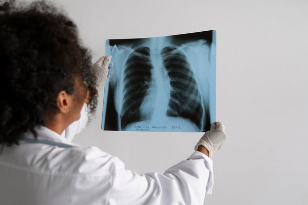 Doctor de vista lateral mirando radiografía